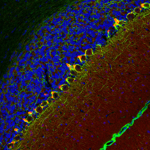 PSD95 免疫荧光法大鼠脑细胞