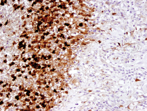 IL-112242β (3A6) Mouse mAb