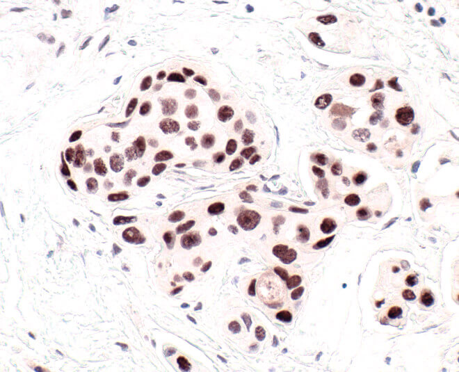 HP1 IHC