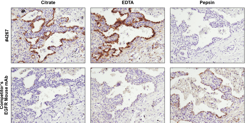 EGF Receptor (D38B1) XP® 兔单克隆抗体 #4267