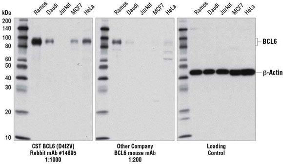 BCL6 兔单抗蛋白质印迹法