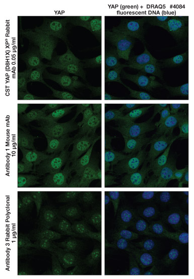 免疫荧光竞争产品与 YAP #14074 的对比（C2C12 小鼠细胞）