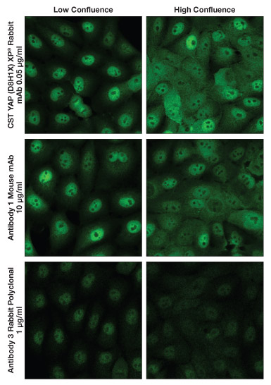 免疫荧光竞争产品与 YAP #14074 的对比（MCF10A 细胞）